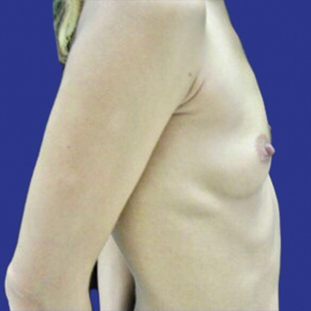 Procedure before and after - before