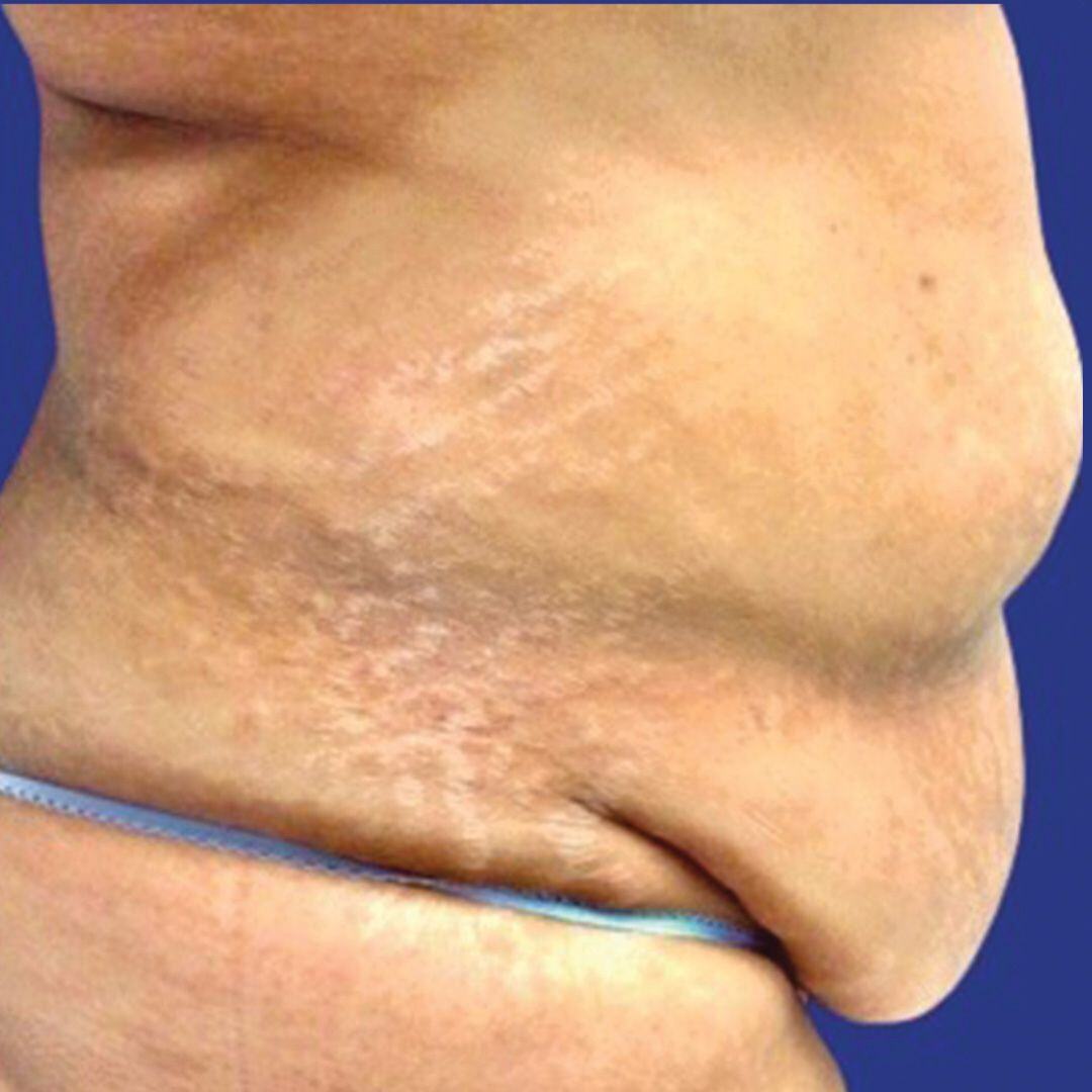 Procedure before and after - before