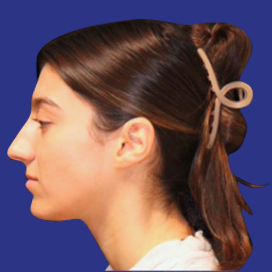 Procedure before and after - before