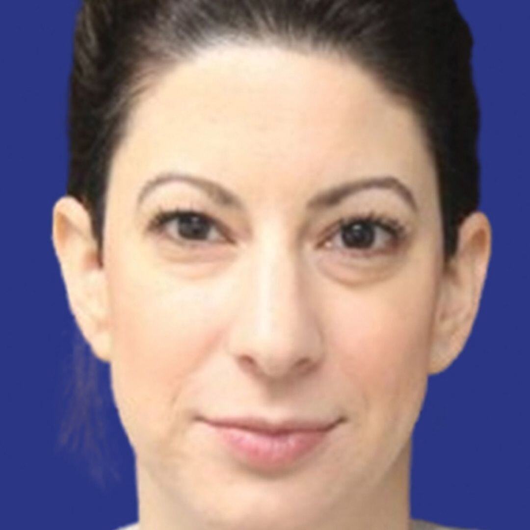 Procedure before and after - before