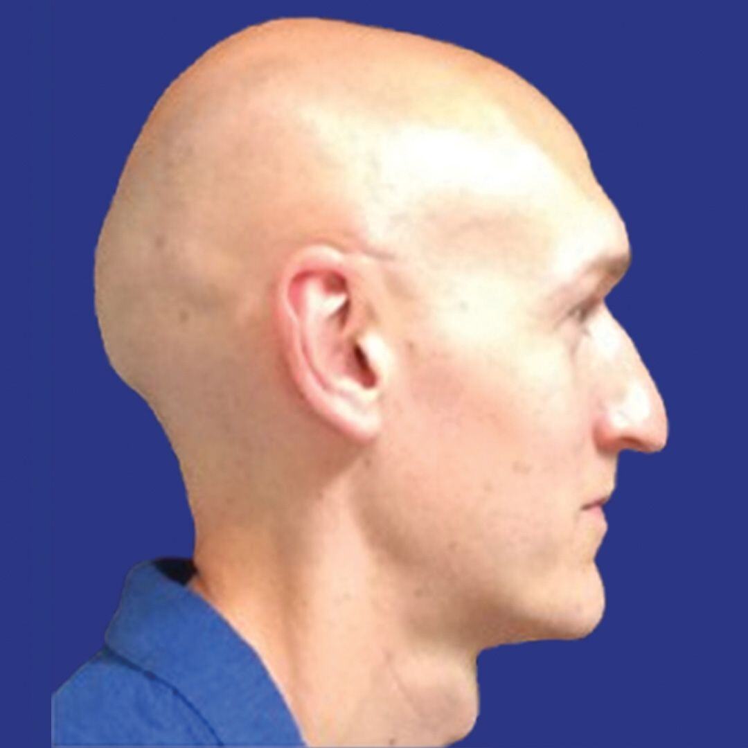 Procedure before and after - before
