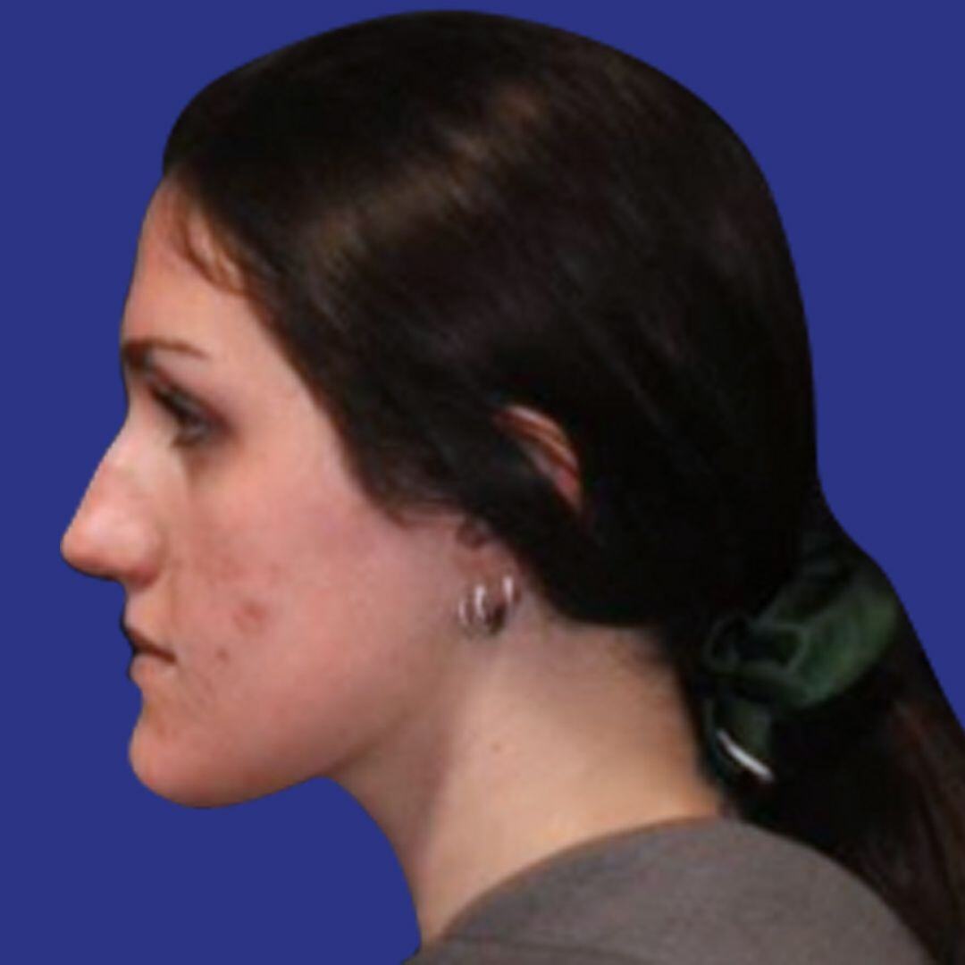 Procedure before and after - before