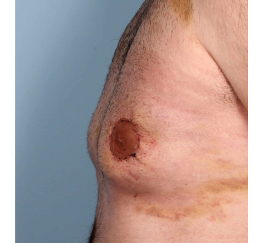 Procedure before and after - after