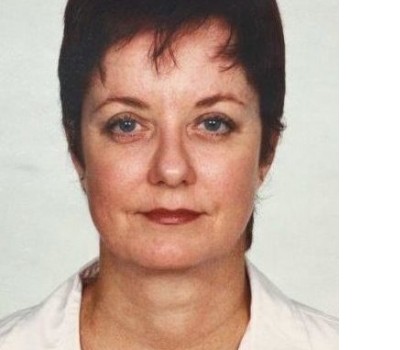 Blepharoplasty before and after - after