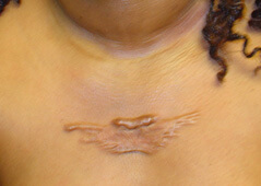Procedure before and after - before