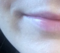 Procedure before and after - before