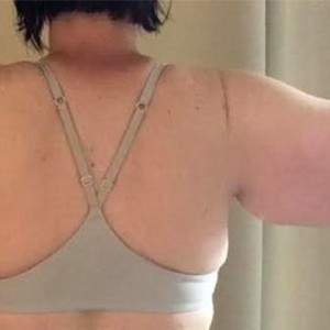 Procedure before and after - after
