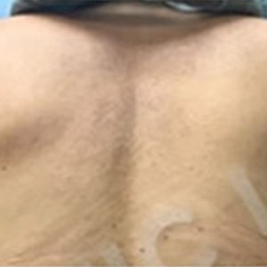 Procedure before and after - after