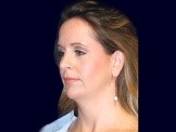 Chin Liposuction before and after - before