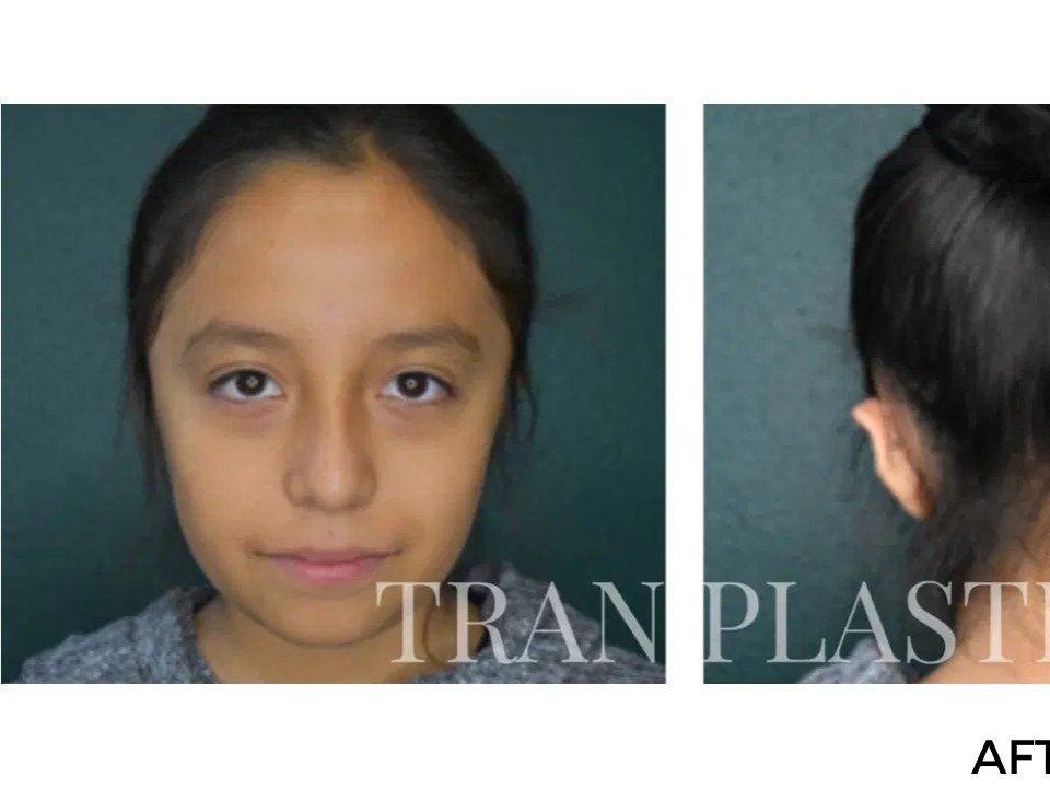 Procedure before and after - before