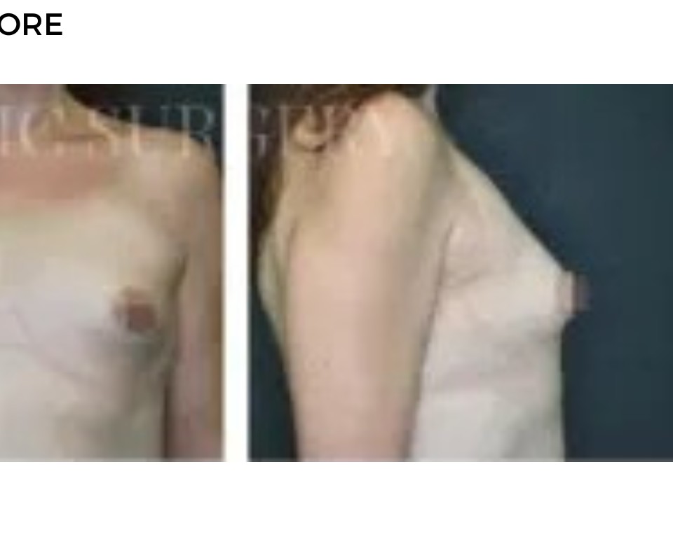 Procedure before and after - after
