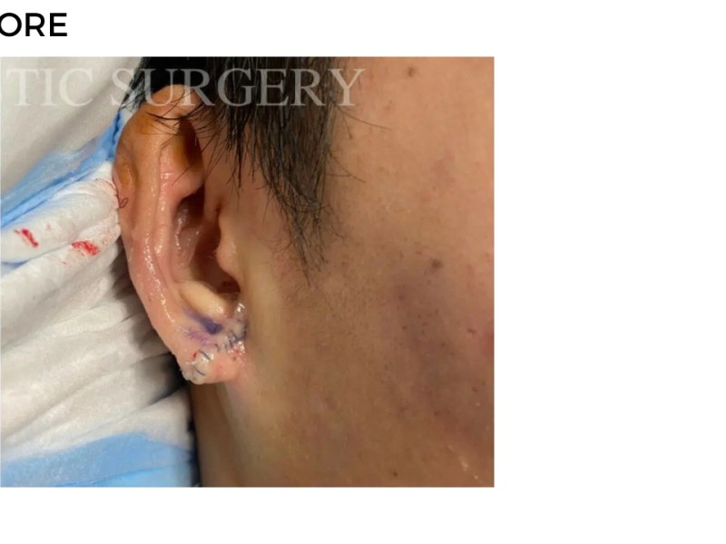 Procedure before and after - after