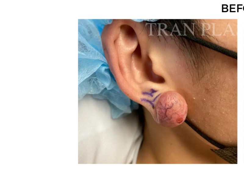 Procedure before and after - before