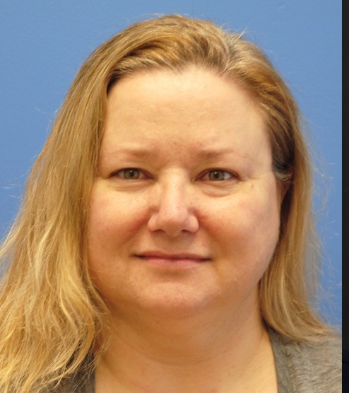 Rhinoplasty and Blepharoplasty before and after - before