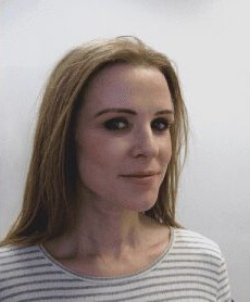 Facelift before and after - after
