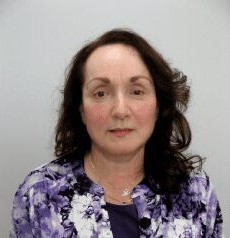 Facelift before and after - after