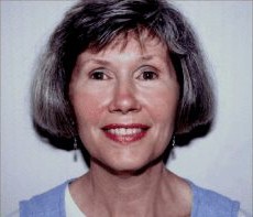 Facelift before and after - after