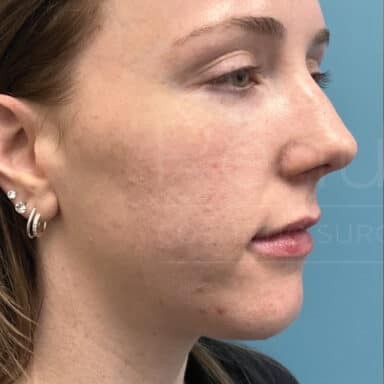 Procedure before and after - before