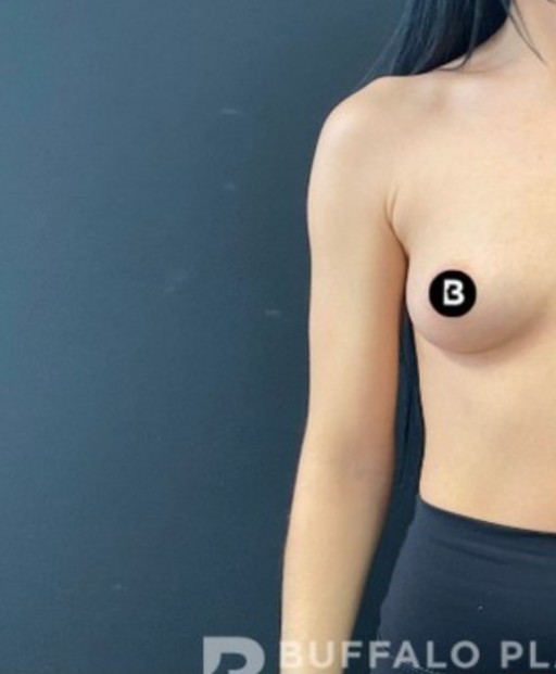 Procedure before and after - before