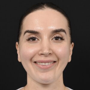 Procedure before and after - after