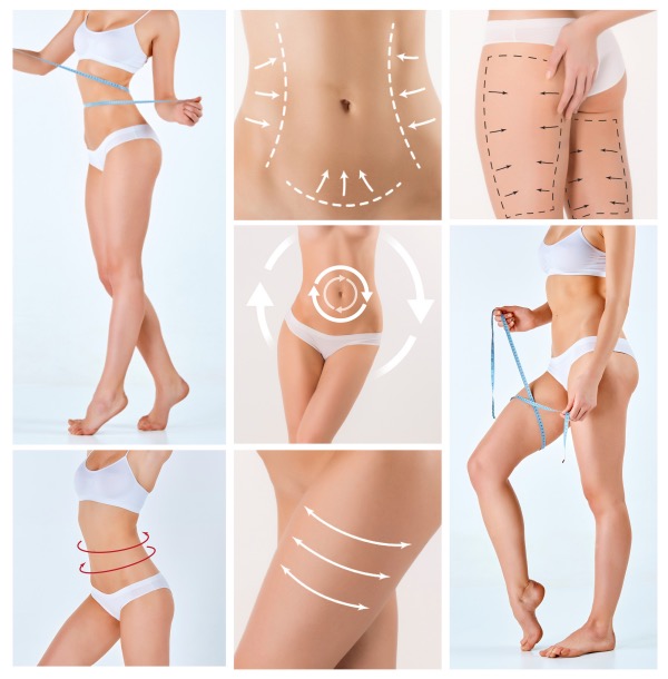 Liposuction before and after - before