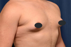 Other procedures by Dr. Michael Frederick — before