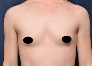 Other procedures by Dr. Michael Frederick — before