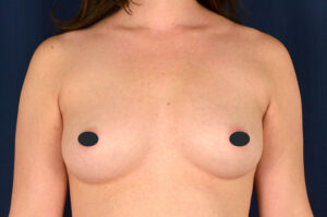 Other procedures by Dr. Michael Frederick — before