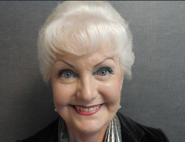 Facelift before and after - after