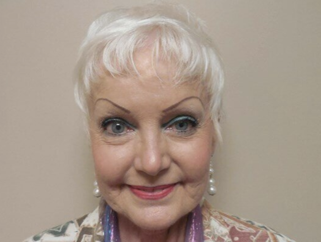 Facelift before and after - before