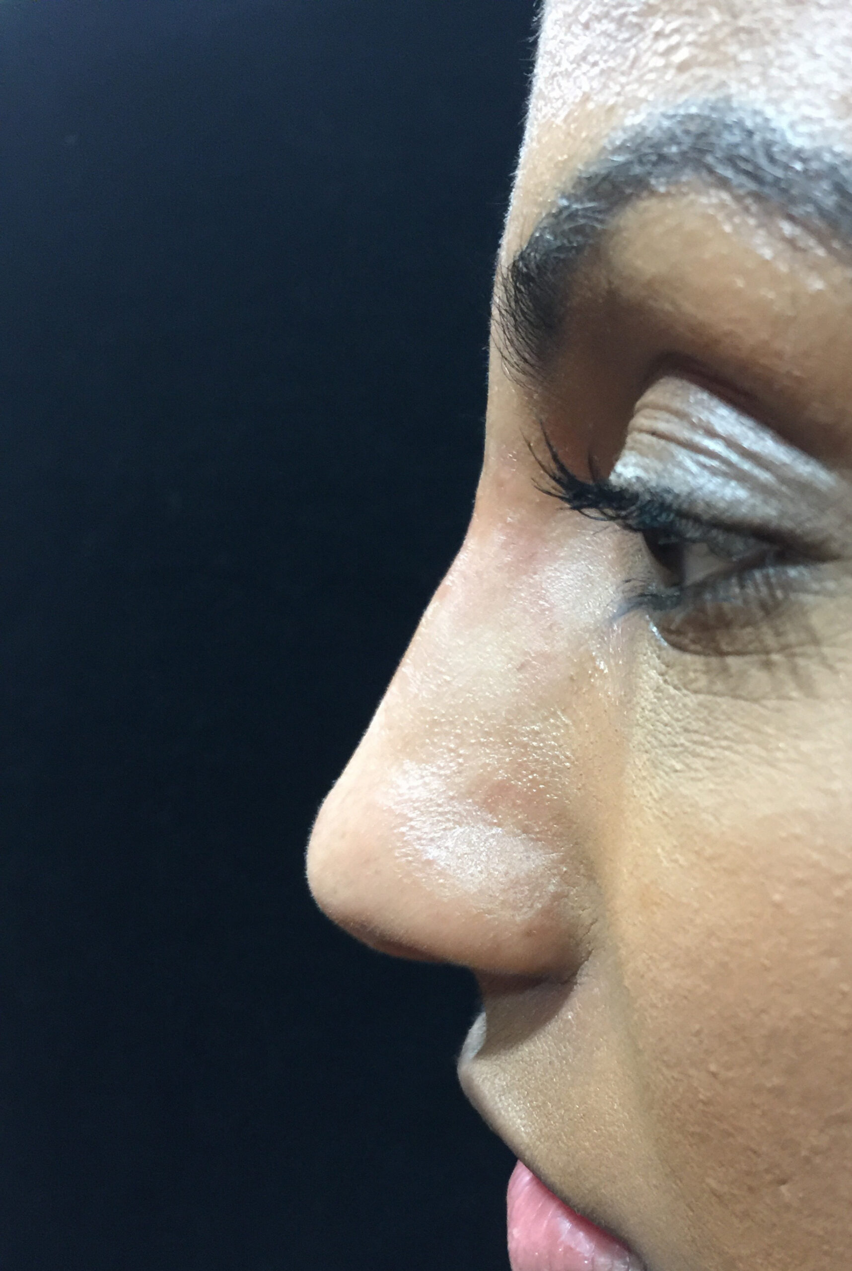 Procedure before and after - after