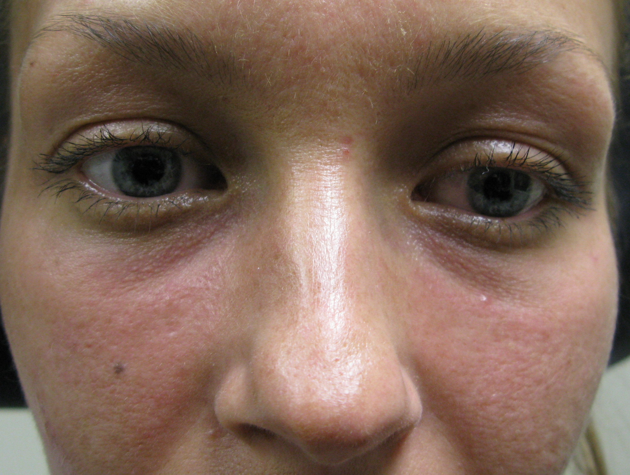 Procedure before and after - before
