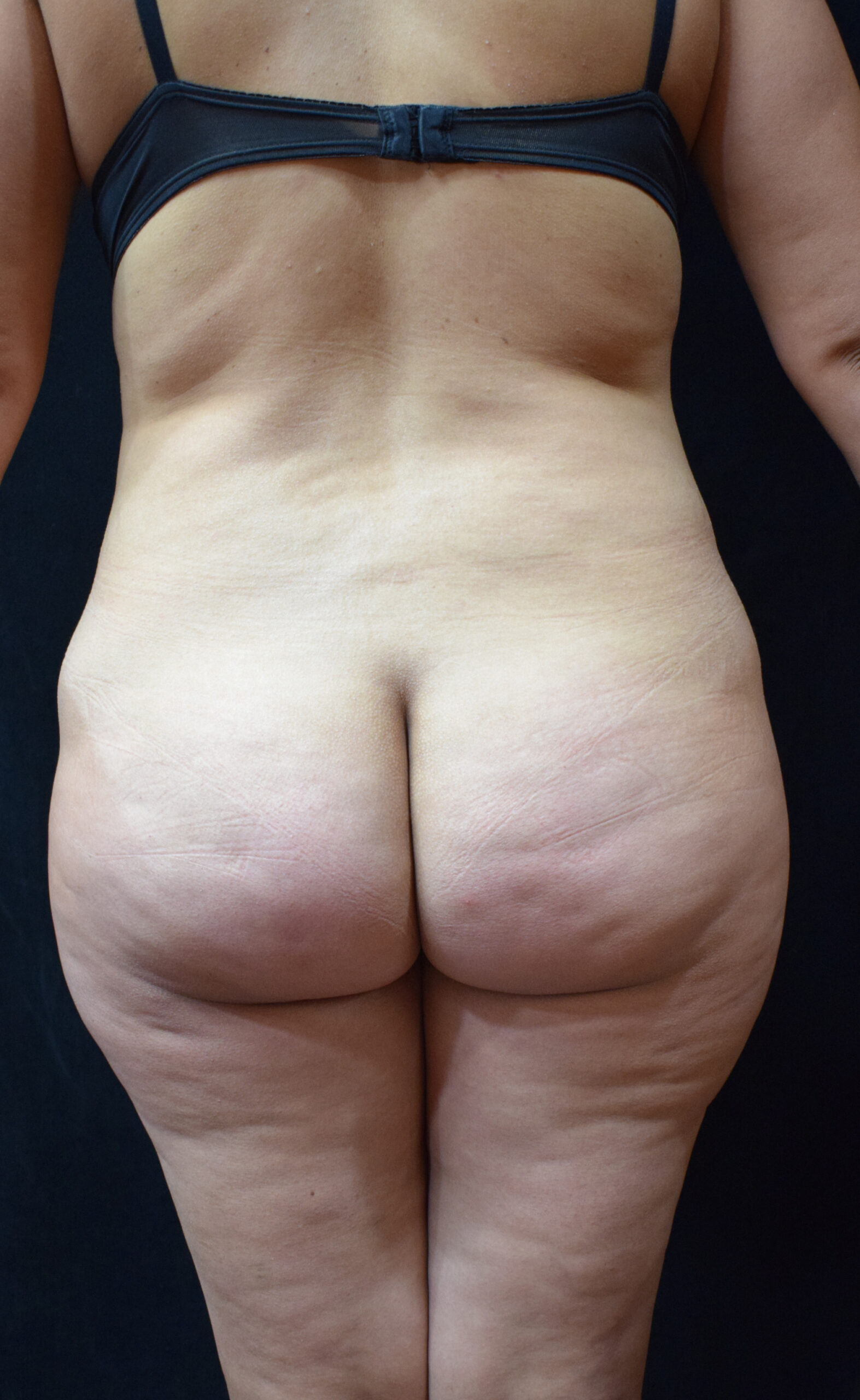 Procedure before and after - before