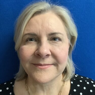 Facelift before and after - after