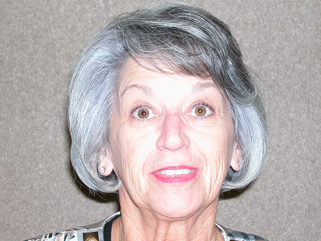 Facelift before and after - before